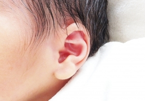 耳切れはアトピーの判断基準なのか 赤ちゃんのアトピー こんな時はどうしたらいい